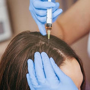 روش درمان ریزش مو با مزوتراپی مو